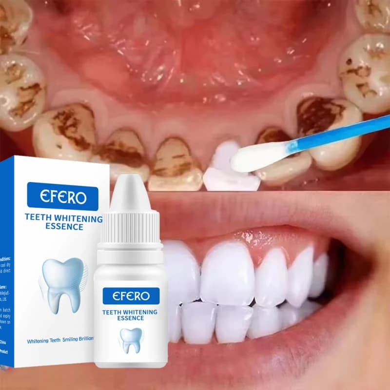 Dentifrice anti-tartre blanchissant, élimination de la mauvaise haleine, éclaircissement des dents, 